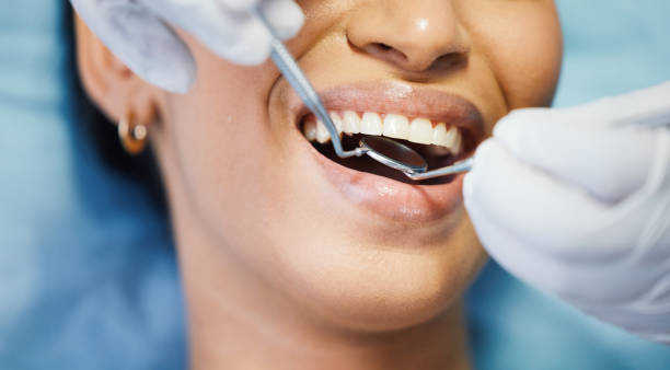 Best Weekend Emergency Dental Services in Chandler, IN