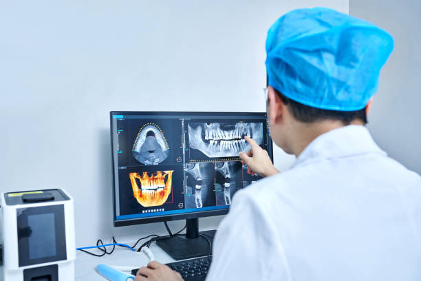 Best Knocked-Out Tooth (Avulsed Tooth) Treatment in Chandler, IN